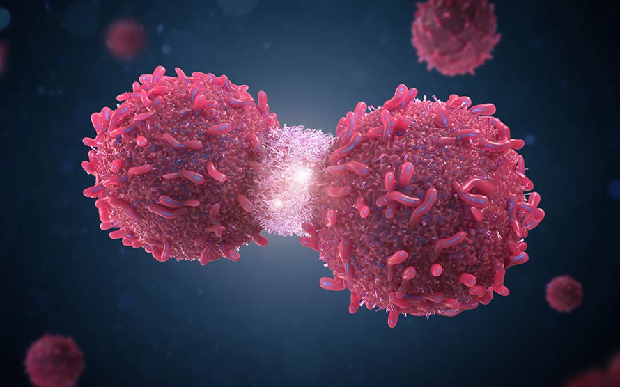 5 Warning Signs of a Hormone-Secreting Tumor
