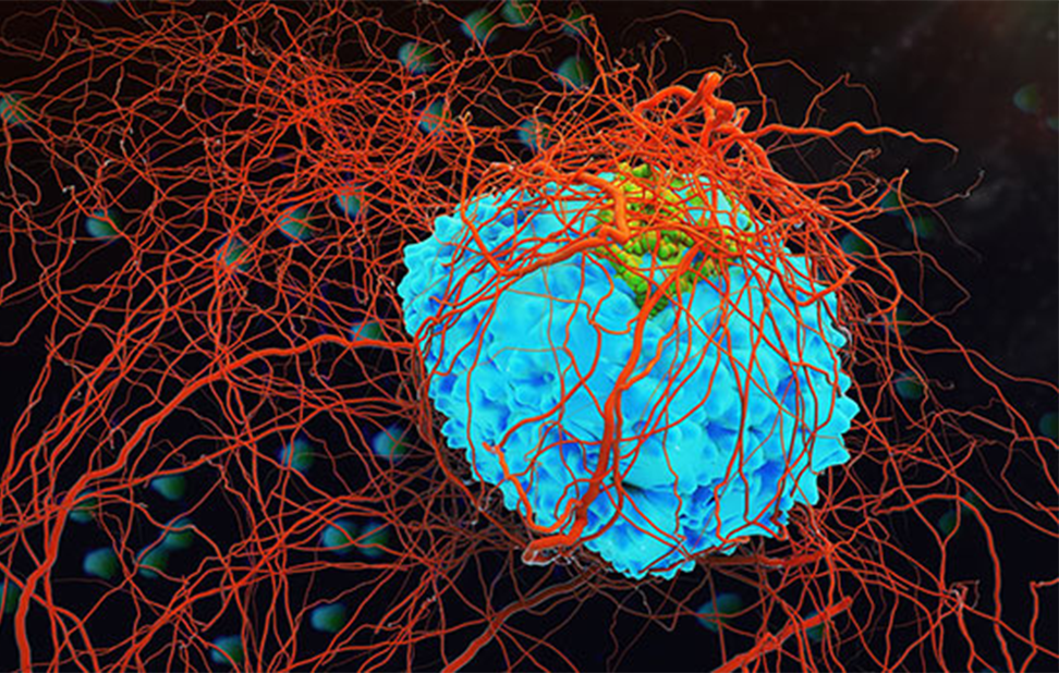 Pembrolizumab & Hypothyroidism: A Common Endocrine Side Effect in Oncocrinology